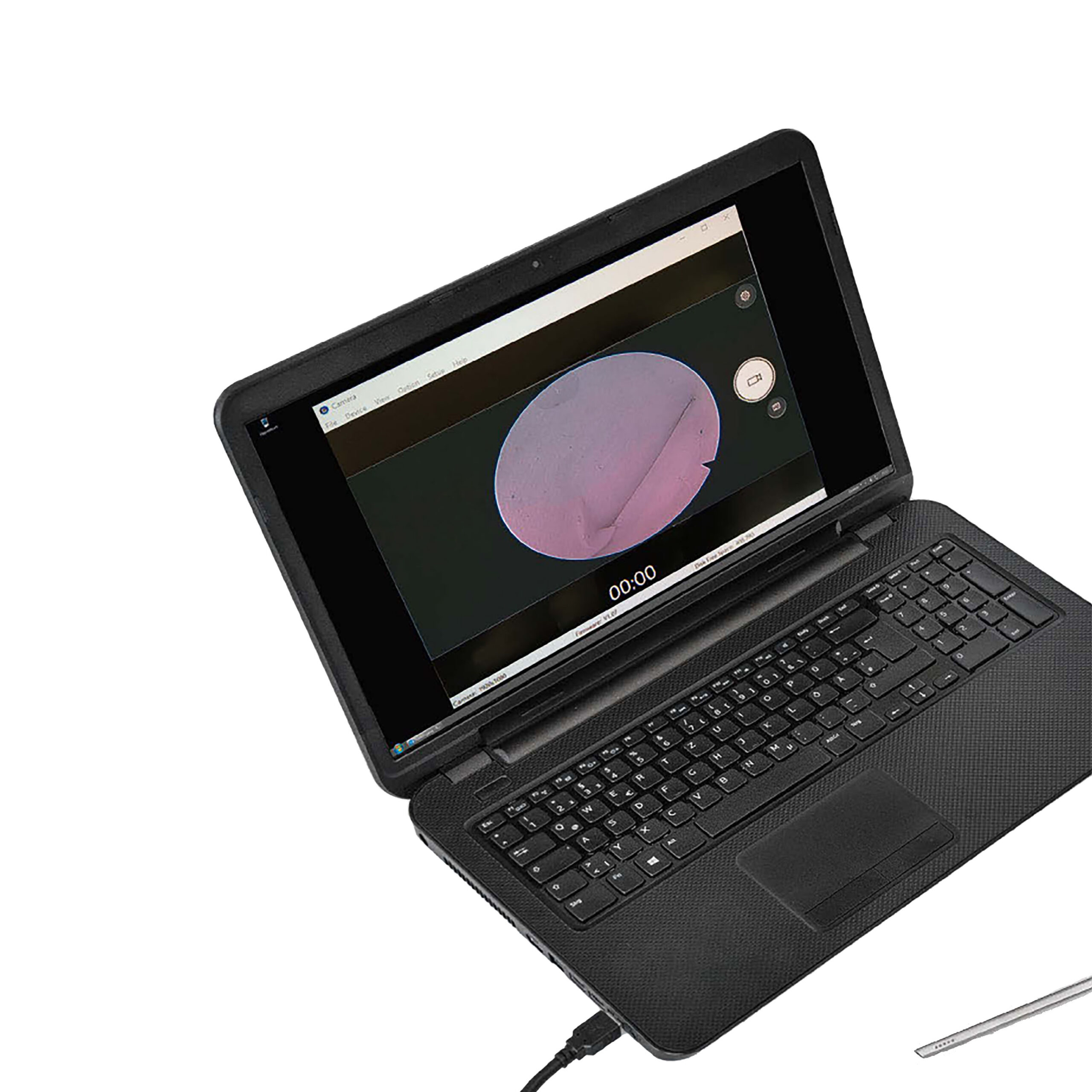Endoskopisk USB-kamera med ljuskälla - Bild 3